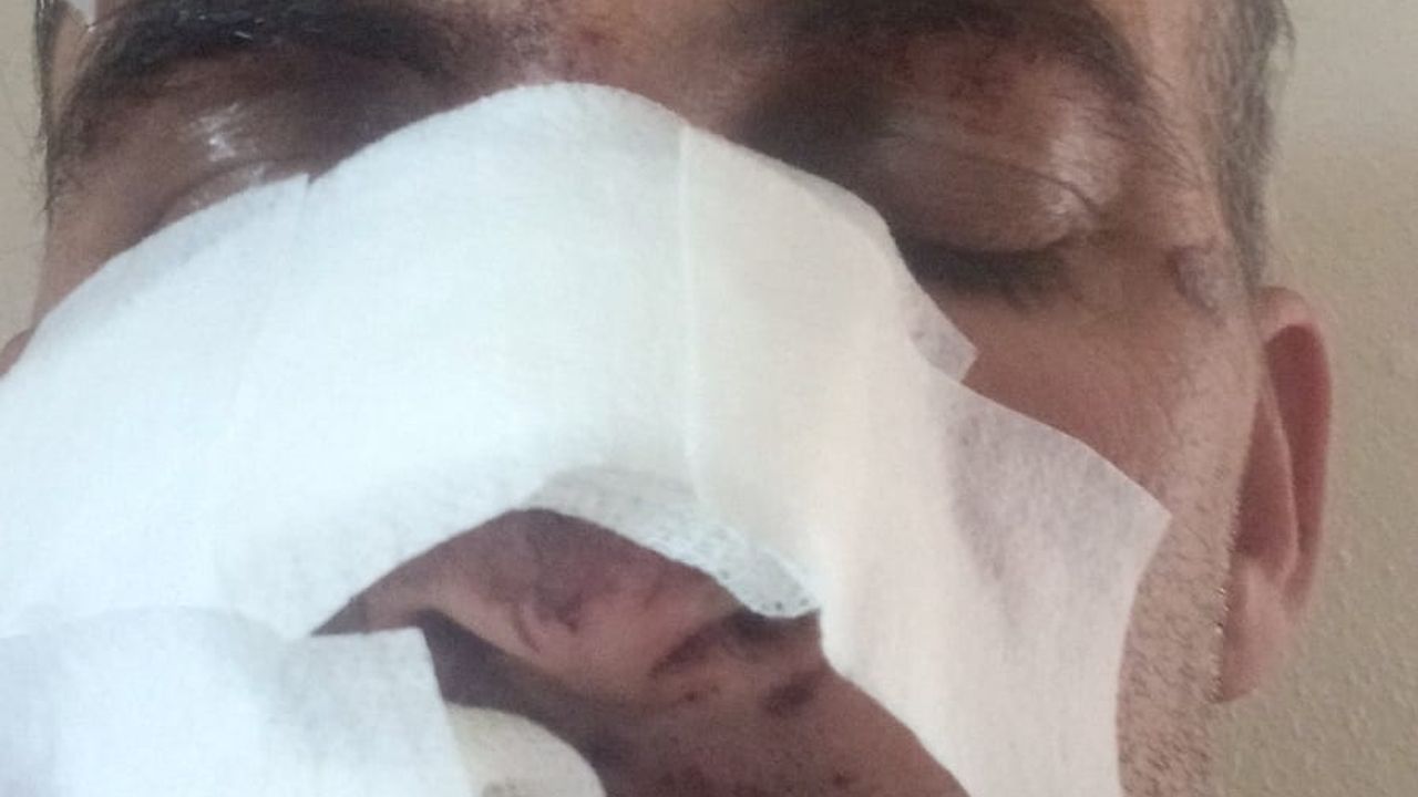 Eniştesine araçla çarpıp kaçtı; o anlar kamerada / Video eklendi