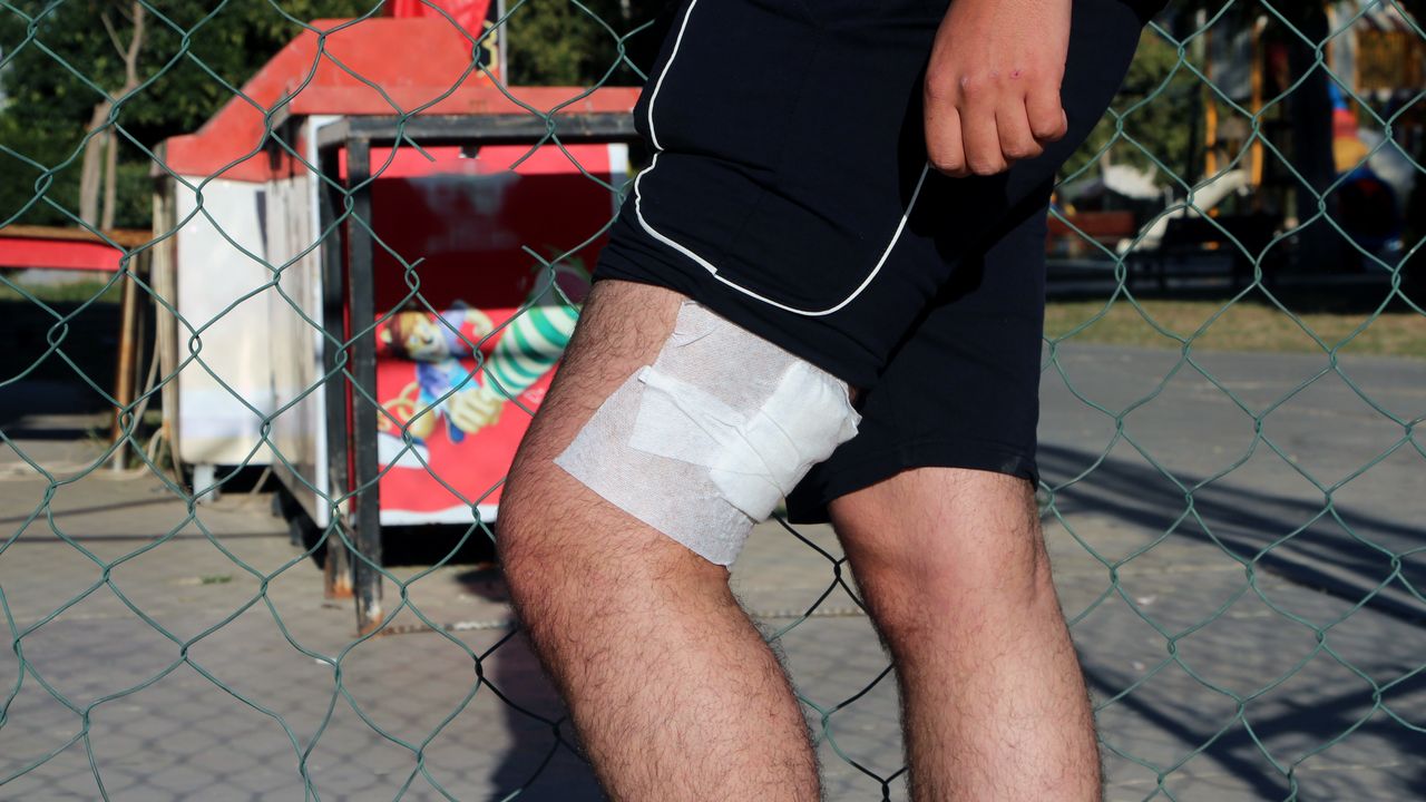 Parkta lise öğrencilerini dövüp, bıçaklayan 6 şüpheli yakalandı; 1 tutuklama