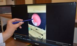 10 aylık bebeğin nefes borusuna şeker ambalajı kaçtı; operasyonla çıkarıldı