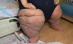 İstanbul - 270 kilo Mehmet: 15 aydır evden çıkamıyorum, yardım edin