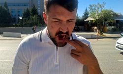 Ankara'da taksiciyi darbeden 4 şüpheli yeniden gözaltına alındı