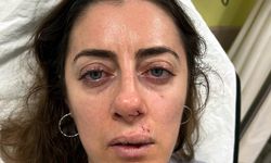 Eşinin sevgilisi sandığı kadını darbettiği 'otomobil kapısı', 'silah' sayıldı