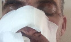 Eniştesine araçla çarpıp kaçtı; o anlar kamerada / Video eklendi