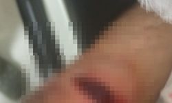 Mardin'de 2 aile arasında kavga; 4 yaralı, kaçan şüpheli aranıyor