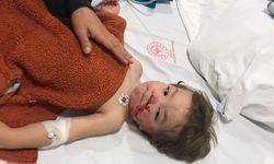 Ankara'da pitbull saldırısına uğrayan 1,5 ve 5 yaşındaki kardeşler yaralandı (2)- Yeniden