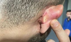 Artvin'de amatör maçta çıkan kavga kamerada