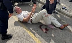 Boşanma aşamasındaki eşini bıçakladı