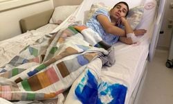 İstanbul- Sultangazi'de yolun karşısına geçerken otomobil çarptı; kaza kamerada