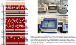 Talasemi hastalığında kan nakli güvenliğini artıran çalışma