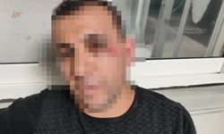 İki ay arayla komşuları tarafından darbedildiler; babanın dişleri kırıldı, anne ile oğlu bıçaklandı