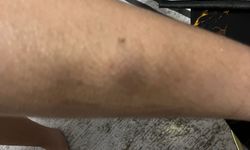 Otizmli öğrenciye darp iddiasına inceleme