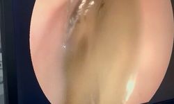 Kedinin midesindeki vantuz, 4 yıl sonra fark edilerek çıkarıldı