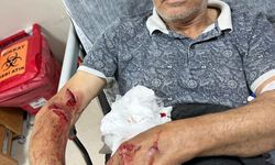 Ordu'da skuterlı çocuk köpeklerin saldırısına uğradı; o anlar kamerada