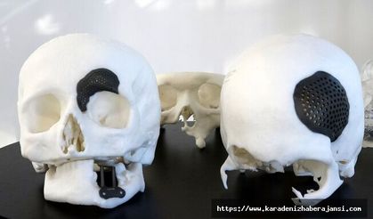 TRABZON KTÜ’de 3D teknolojiyle kişiye özel implant üretimi