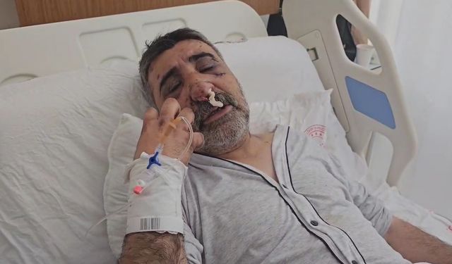 İstanbul - İngiliz boksörün darbettiği taksici konuştu