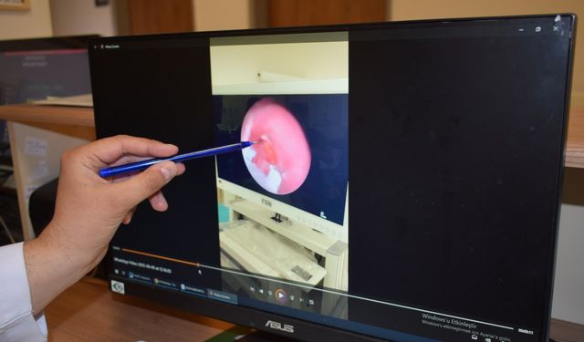 10 aylık bebeğin nefes borusuna şeker ambalajı kaçtı; operasyonla çıkarıldı