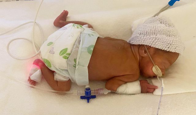 780 gram dünyaya gelen Elfin Maral bebeği, 3 kilo 490 gram olarak annesinin kucağına verdiler / Ek Fotoğraf