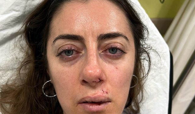 Eşinin sevgilisi sandığı kadını darbettiği 'otomobil kapısı', 'silah' sayıldı