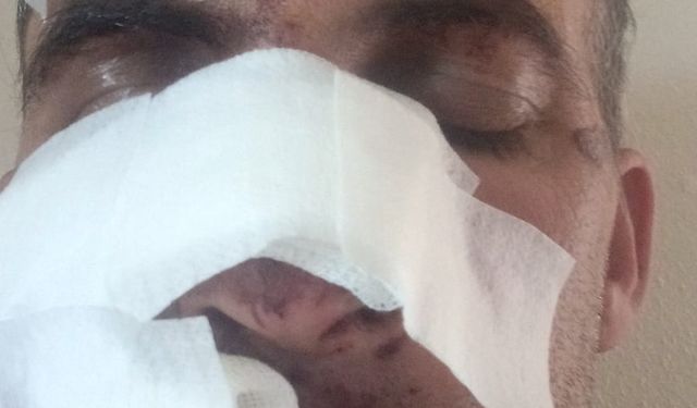 Eniştesine araçla çarpıp kaçtı; o anlar kamerada / Video eklendi