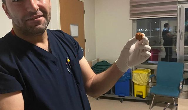 Zihinsel engelli kadının yemek borusuna kaçan ceviz, operasyonla çıkarıldı