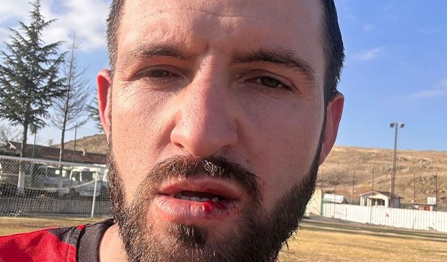 Konya'da amatör ligde kavga: 5 yaralı 