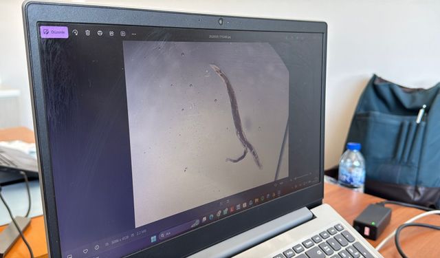 Kuşlarda 'gaga açma hastalığına' neden olan parazitler mercek altında