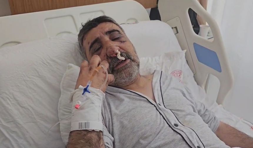 İstanbul - İngiliz boksörün darbettiği taksici konuştu