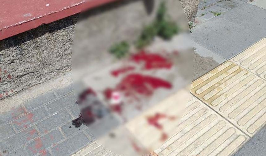 Husumetlilerin silahlı kavgasında yoldan geçen kadın bacağından vuruldu