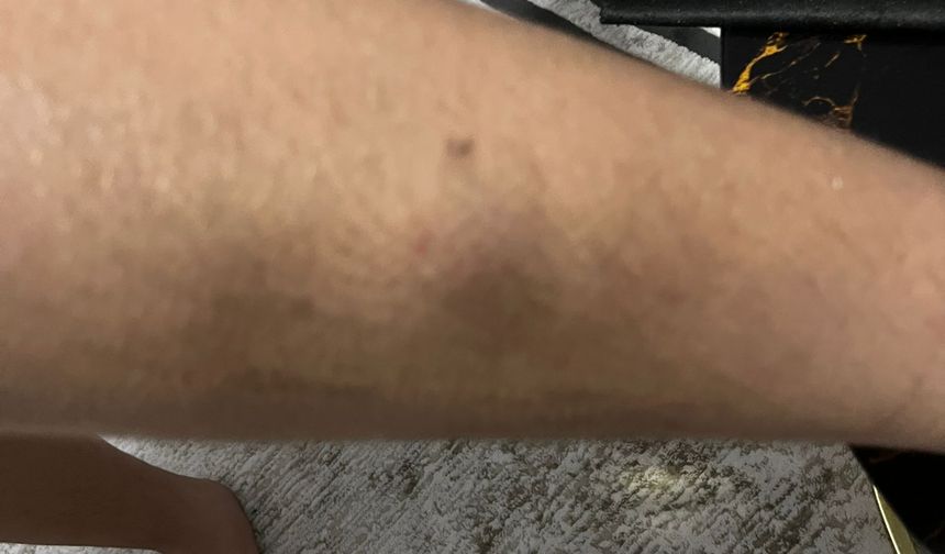 Otizmli öğrenciye darp iddiasına inceleme